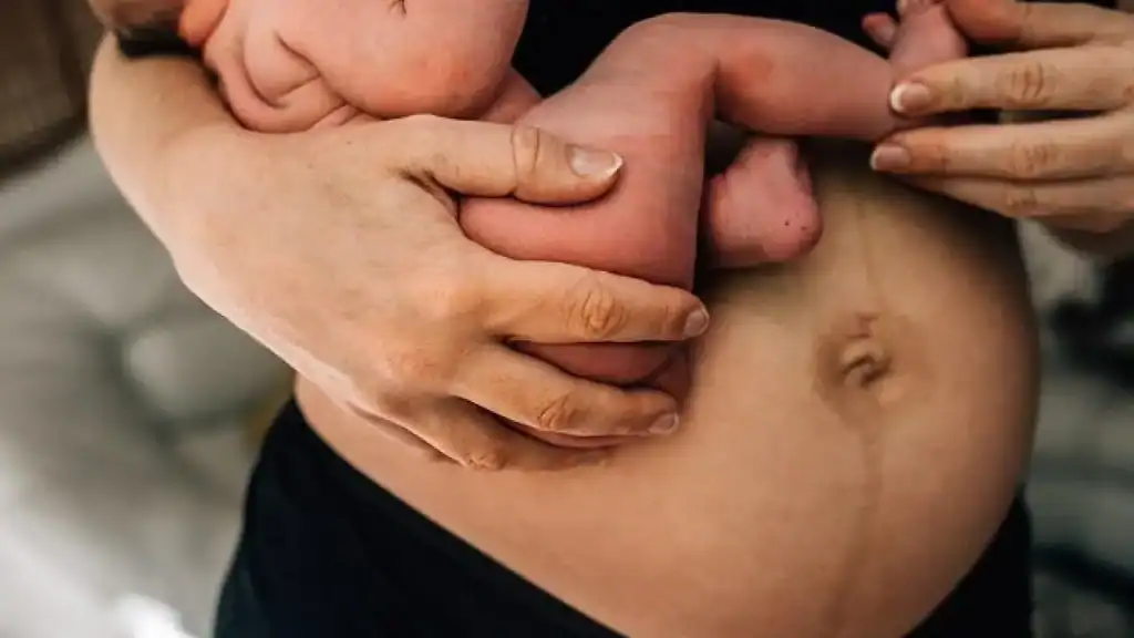 Why Is My Stomach Still Big After Pregnancy Arnold?